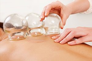 Cupping being used on a persons back