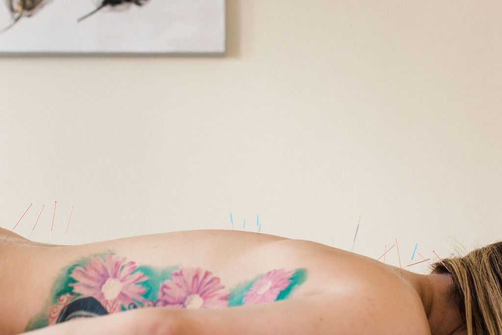 Is Acupuncture For Lower Back Pain Effective?