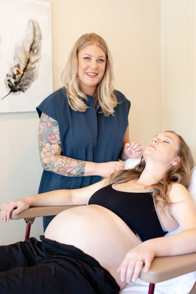 acupuncture for pregnancy