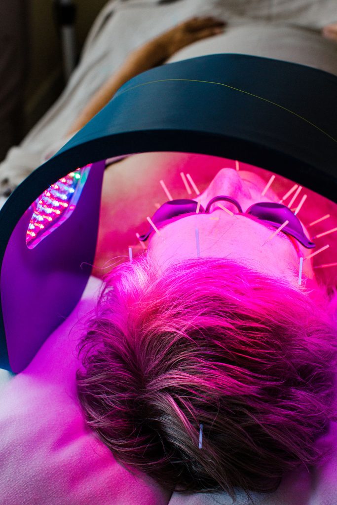 Person receiving facial acupuncture under a pink LED light therapy device while wearing protective goggles.