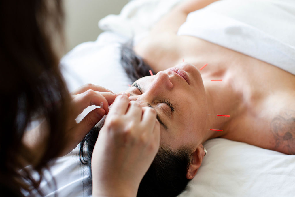 Cosmetic acupuncture before and after treatment with facial needles to support natural, healthy-looking skin.