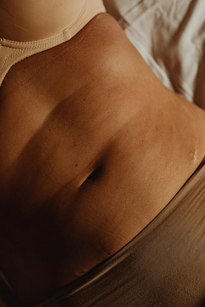 Close-up of a woman’s bare abdomen and lower ribs, highlighting the area often supported with kinesiology tape during pregnancy or postpartum care.