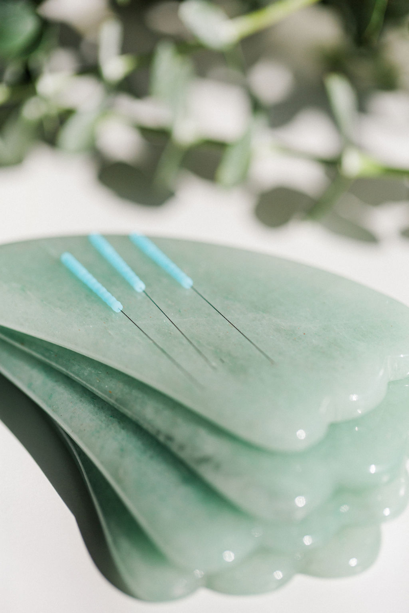 Acupuncture needles prepared for treatment to support chronic bladder pain, circulation, and pelvic health.