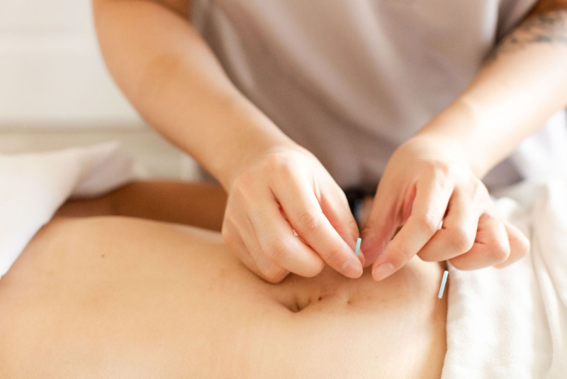 Acupuncture treatment with fine needles to support relief from chronic bladder pain and pelvic discomfort.