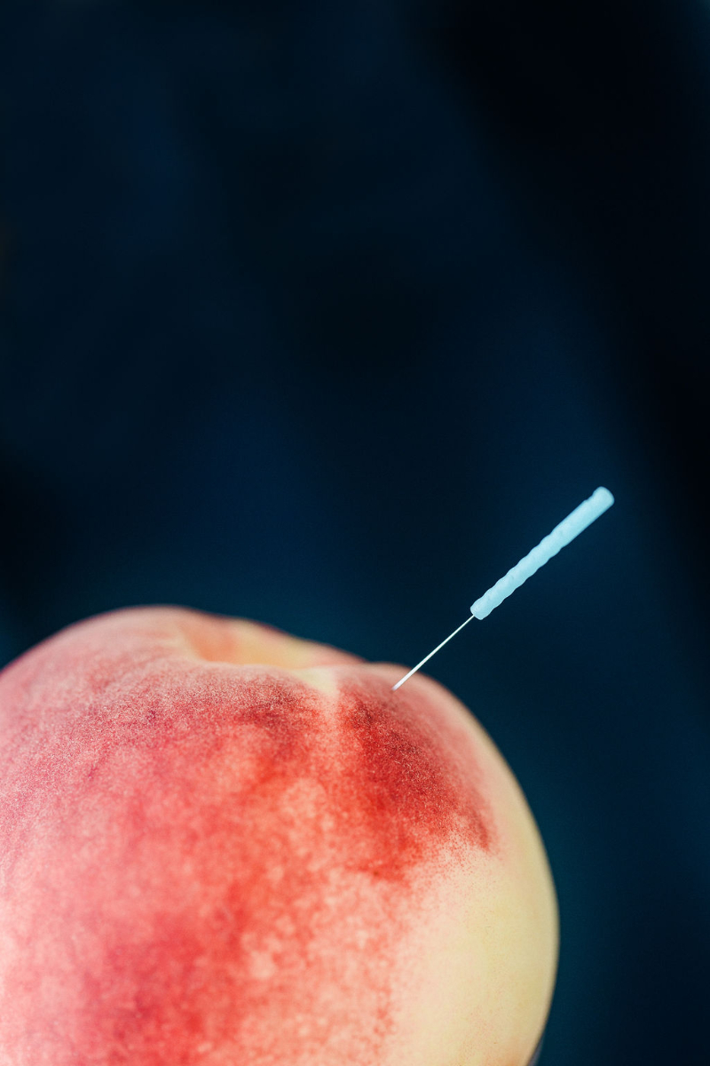 Acupuncture needle placed on the abdomen to support PCOS and fertility, healthy ovulation, and reproductive health.